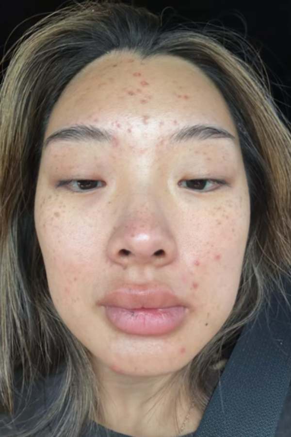 Before - Esther S.