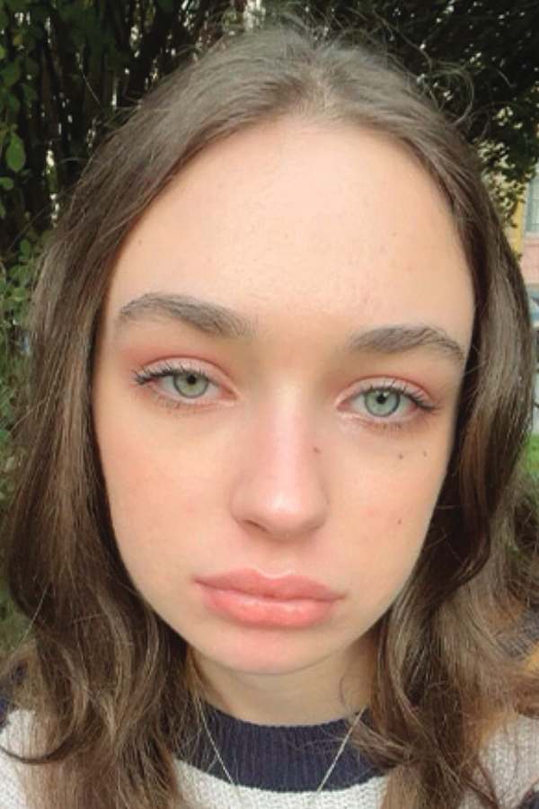 After - Melissa W.