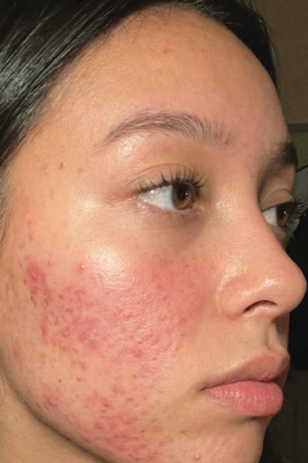 Before - Liz N.