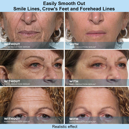 Cureoskin® Instant Face Temporary Tightener – Instant visible results in 30 seconds