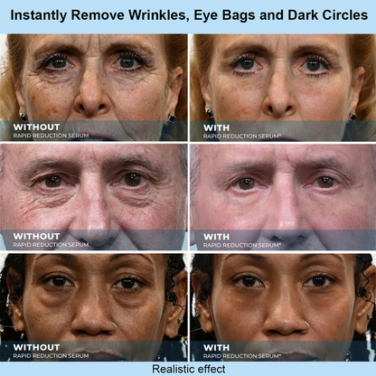 Cureoskin® Instant Face Temporary Tightener – Instant visible results in 30 seconds