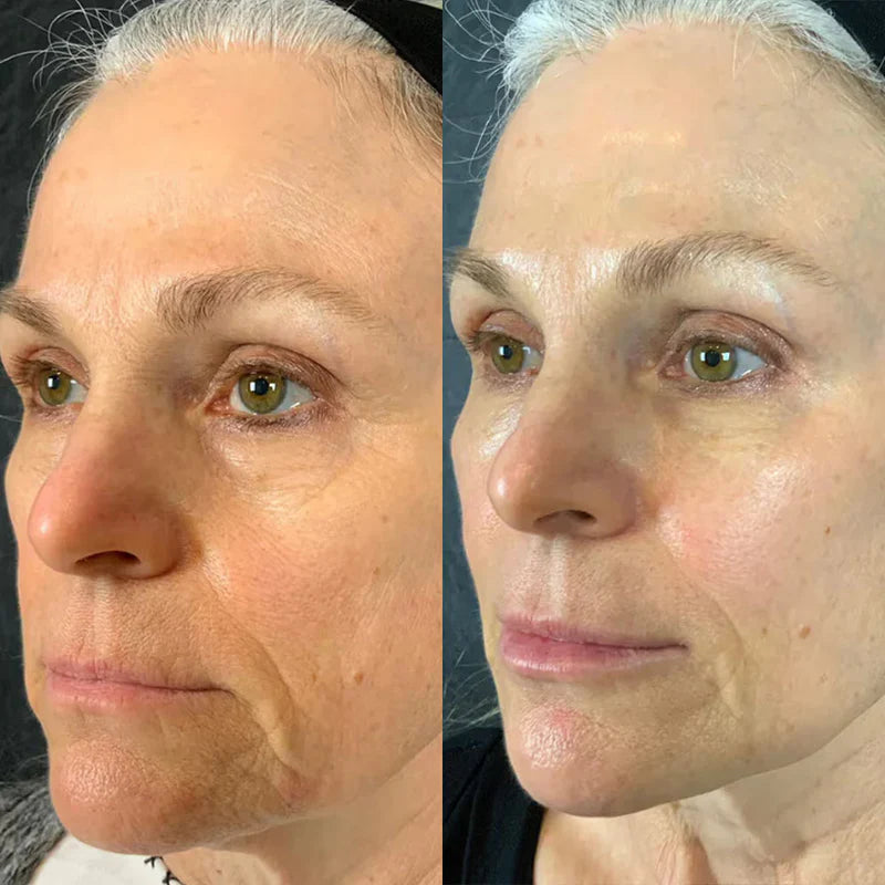 Sarah, 65
