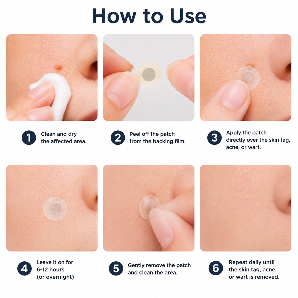 ✨Cureoskin®2-in-1 Microneedle & Hydrocolloid Patch🍀| Removes Raised Moles, Acne, Flat Warts & Skin Tags | Helps Improve Wrinkles, Scars & Blemishes | Invisible Patches for Face & Body