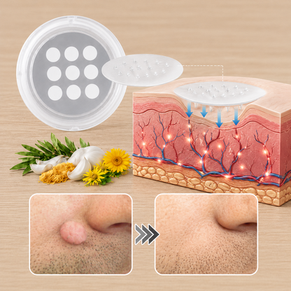 ✨Cureoskin®2-in-1 Microneedle & Hydrocolloid Patch🍀| Removes Raised Moles, Acne, Flat Warts & Skin Tags | Helps Improve Wrinkles, Scars & Blemishes | Invisible Patches for Face & Body